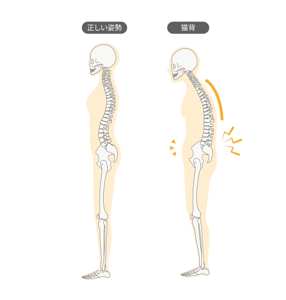 正常姿勢と猫背