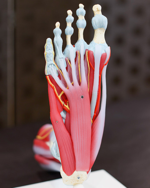 モートン病症状