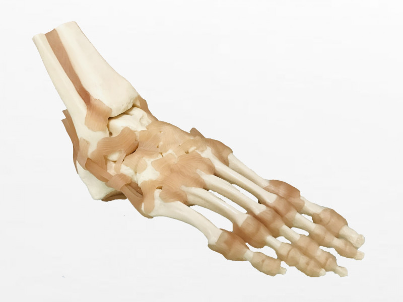 足関節捻挫の靭帯